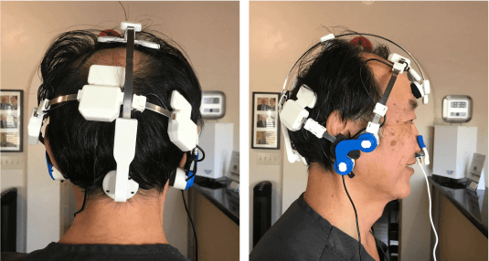 brain-healing-photobiomodulation-1