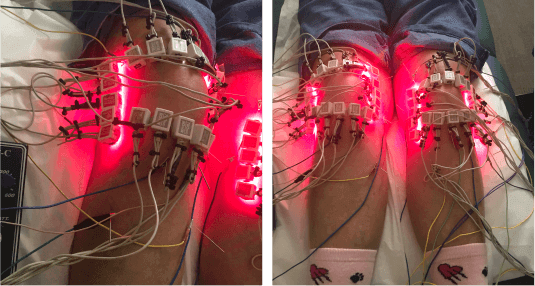 knee-pain-light-therapy