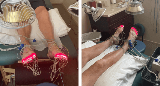 neuropathy-laser-therapy-1